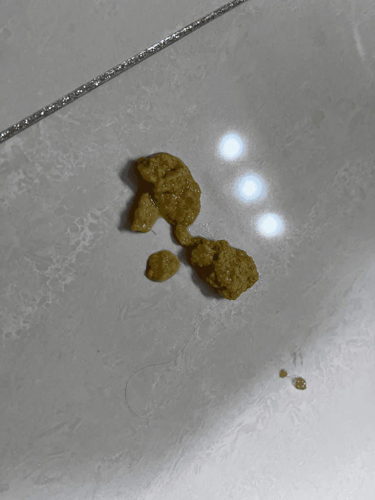 2번 째 사진