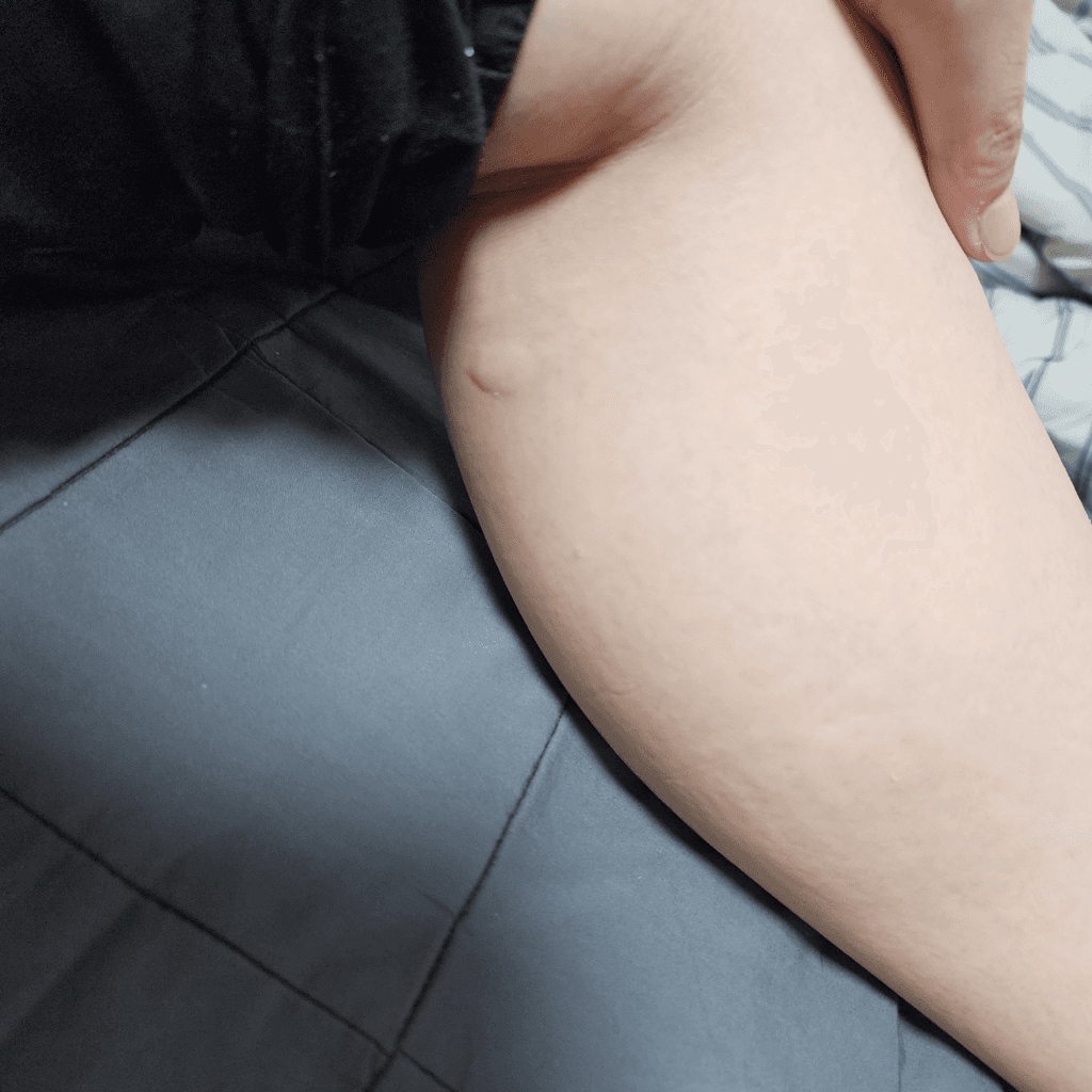 3번 째 사진