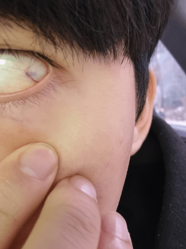 1번 째 사진