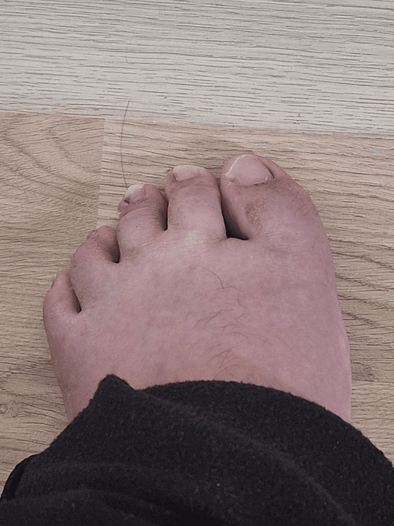 2번 째 사진