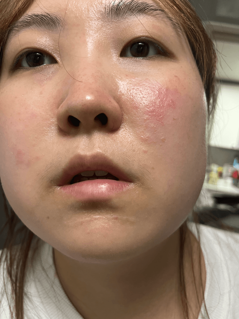 2번 째 사진