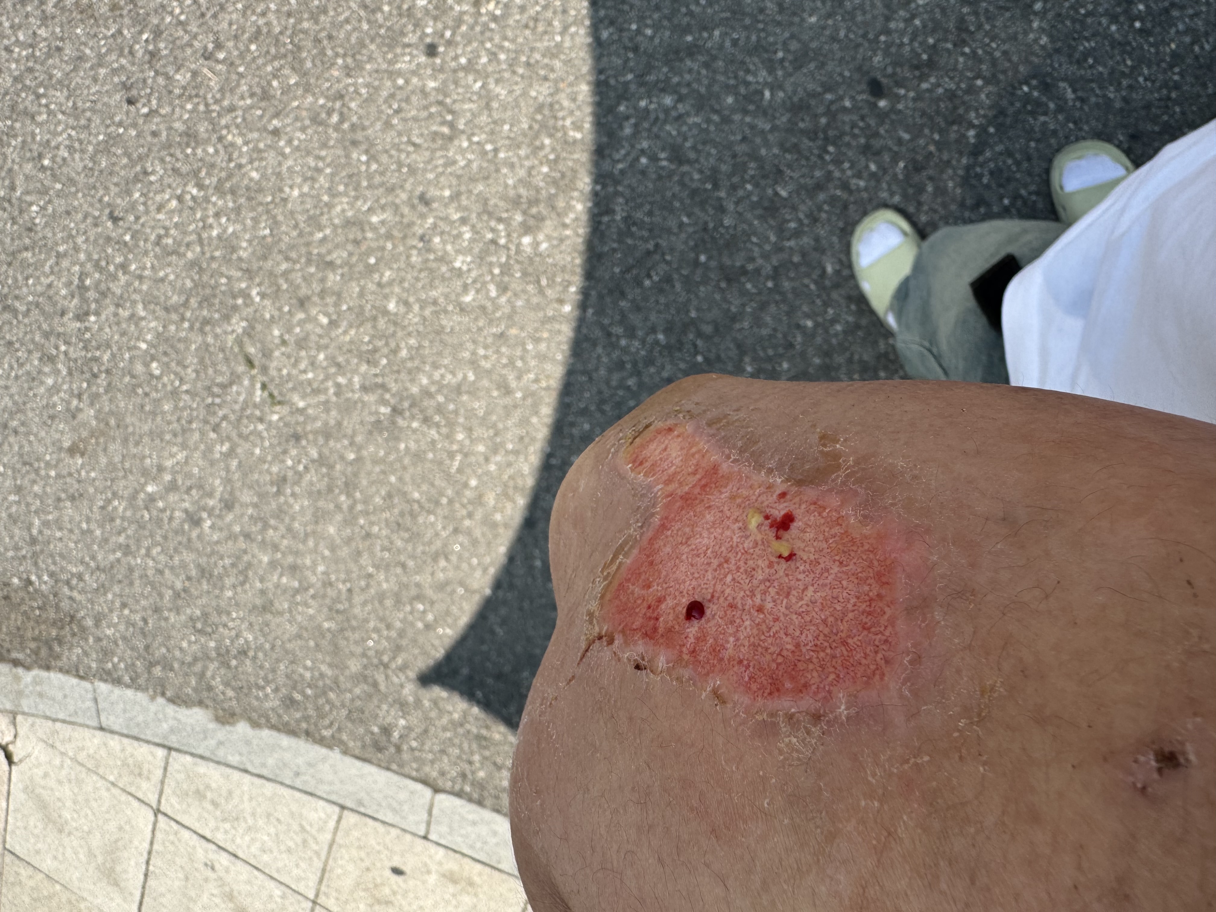 1번 째 사진