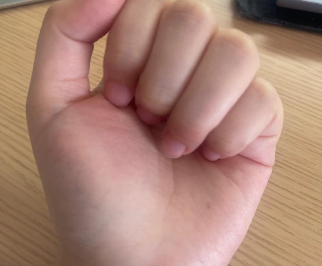 2번 째 사진