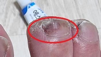 2번 째 사진