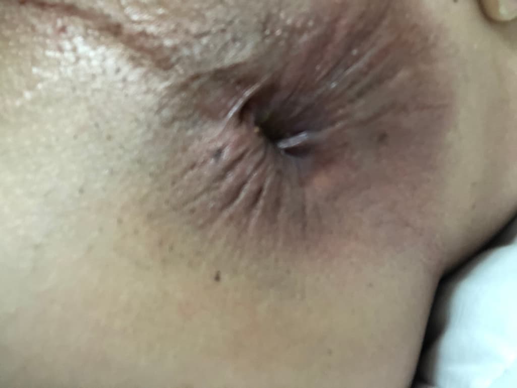 2번 째 사진