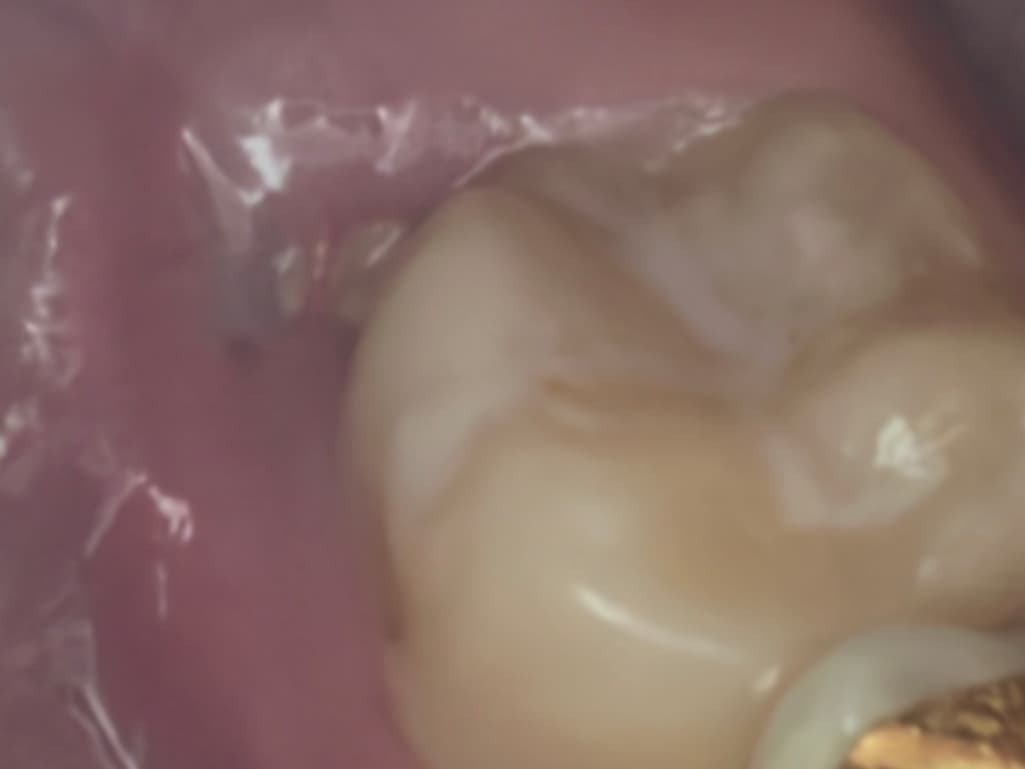 2번 째 사진