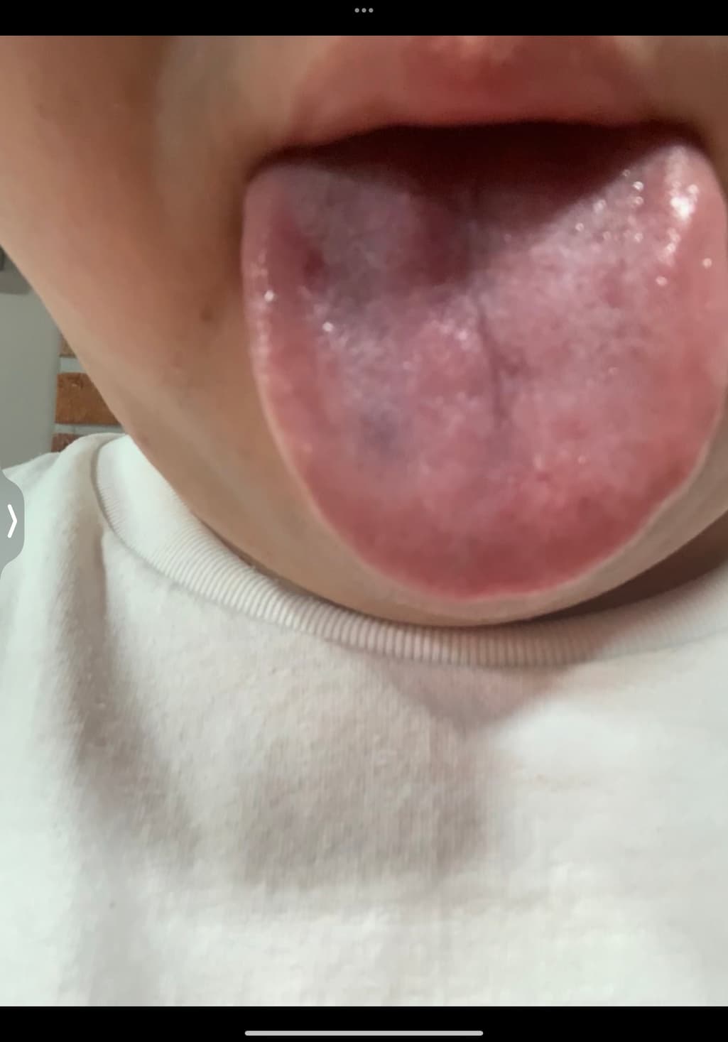 3번 째 사진