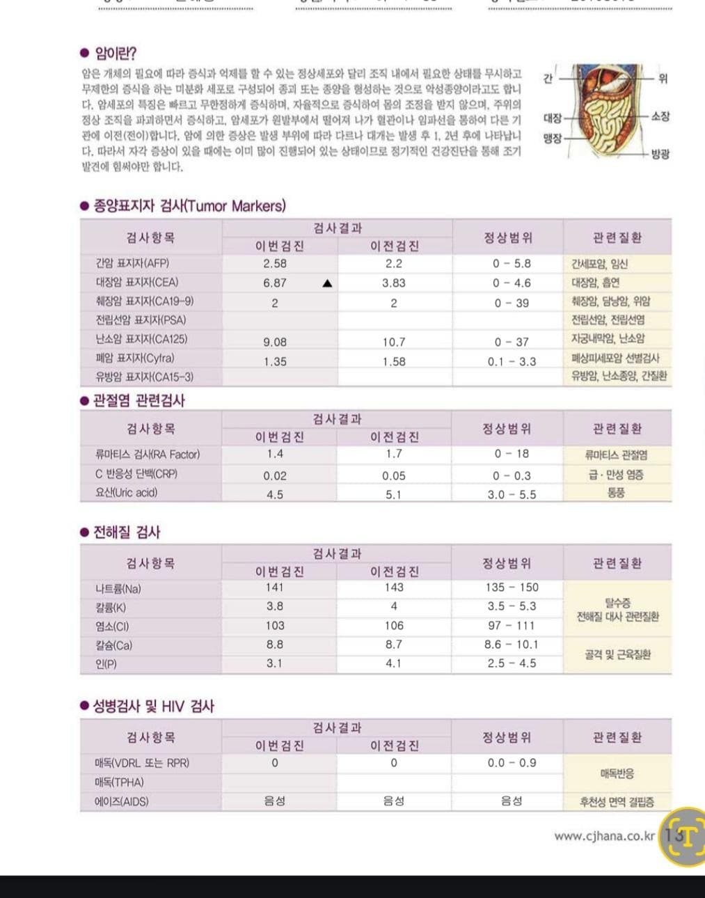 2번 째 사진