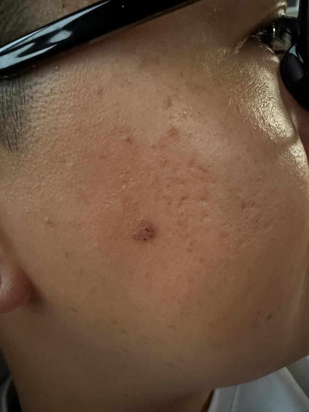 1번 째 사진