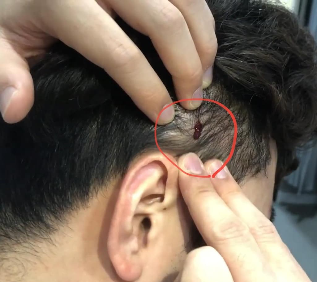 1번 째 사진