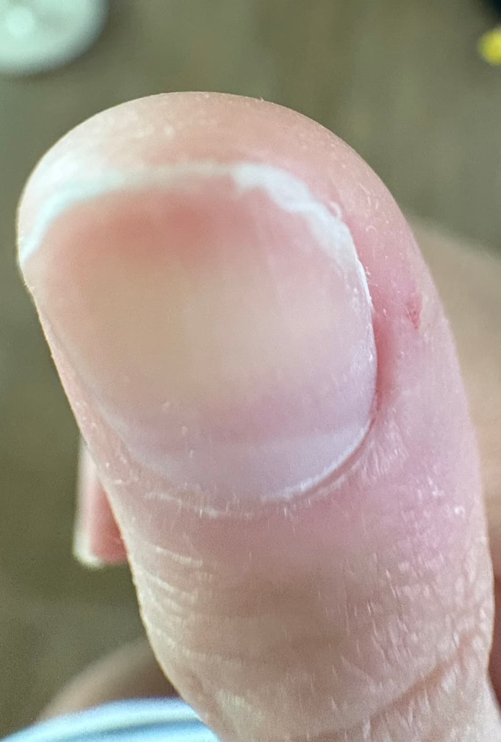 3번 째 사진