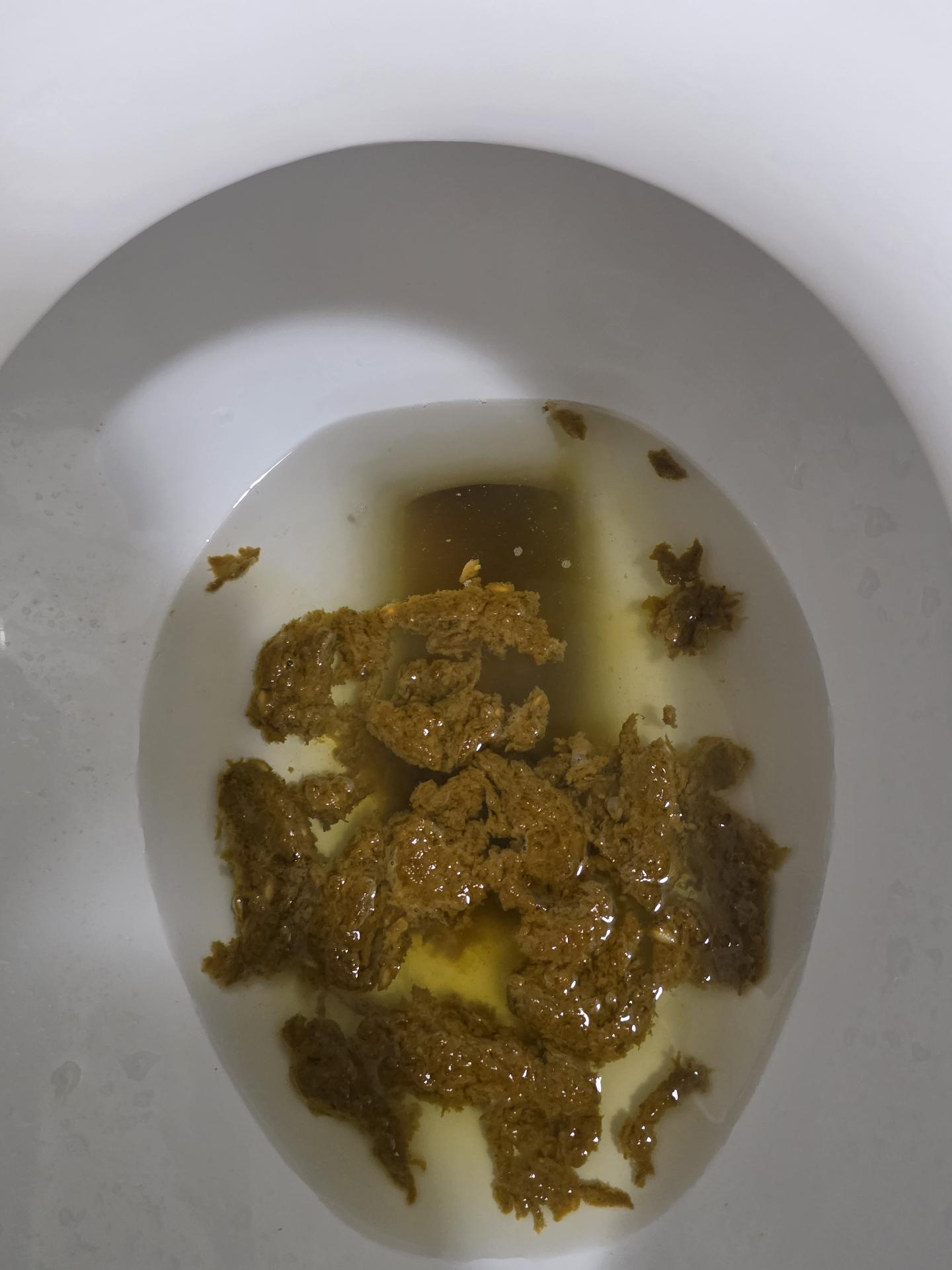 2번 째 사진