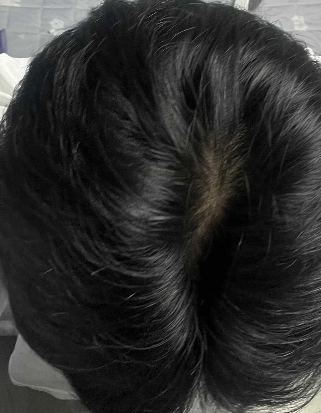 2번 째 사진