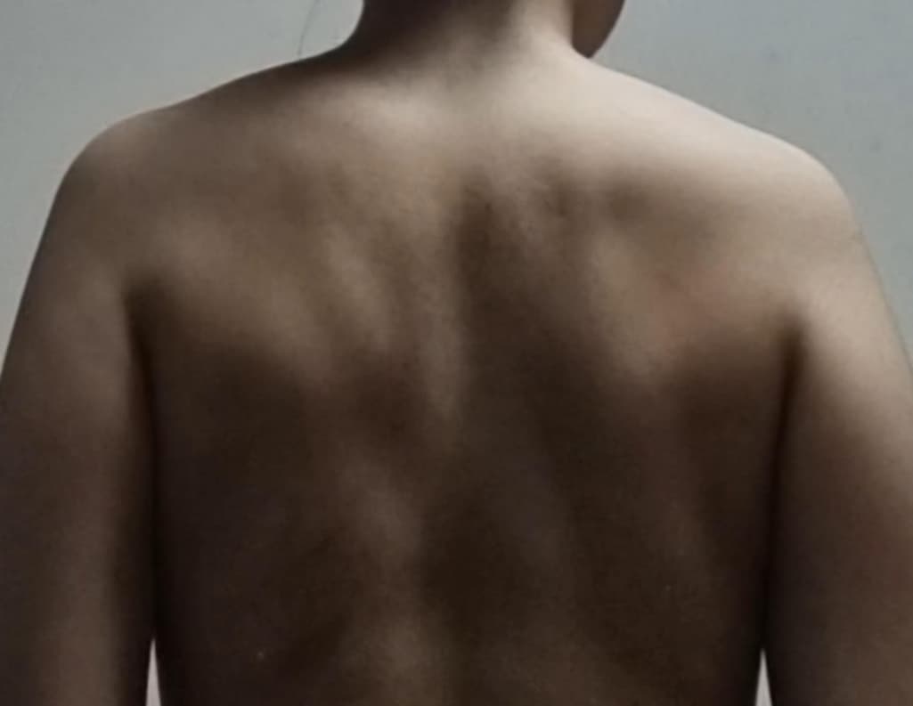 2번 째 사진