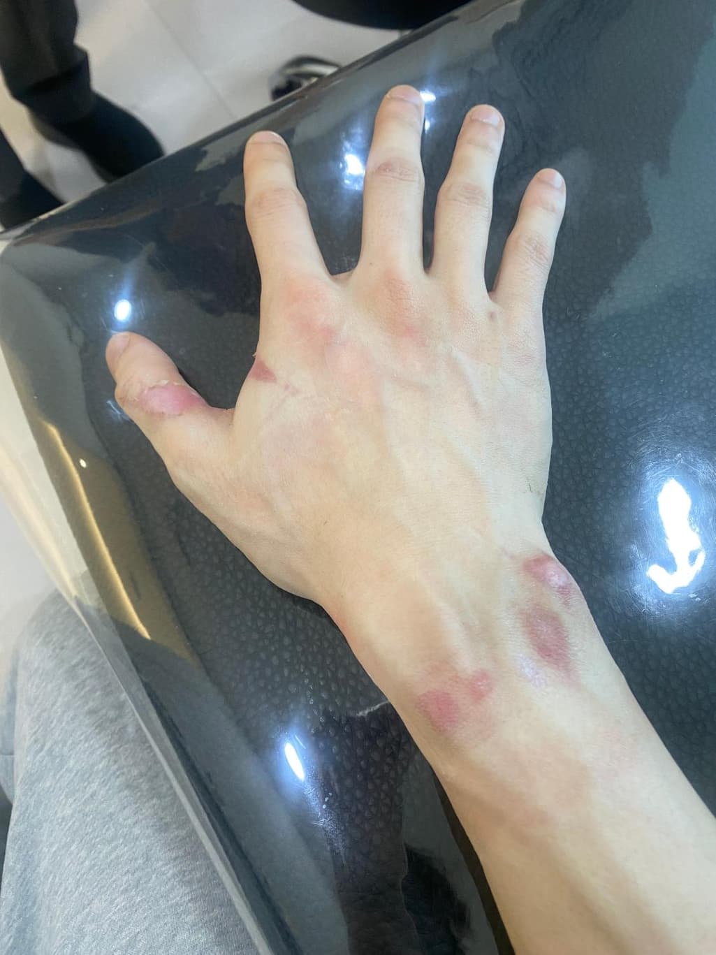 3번 째 사진