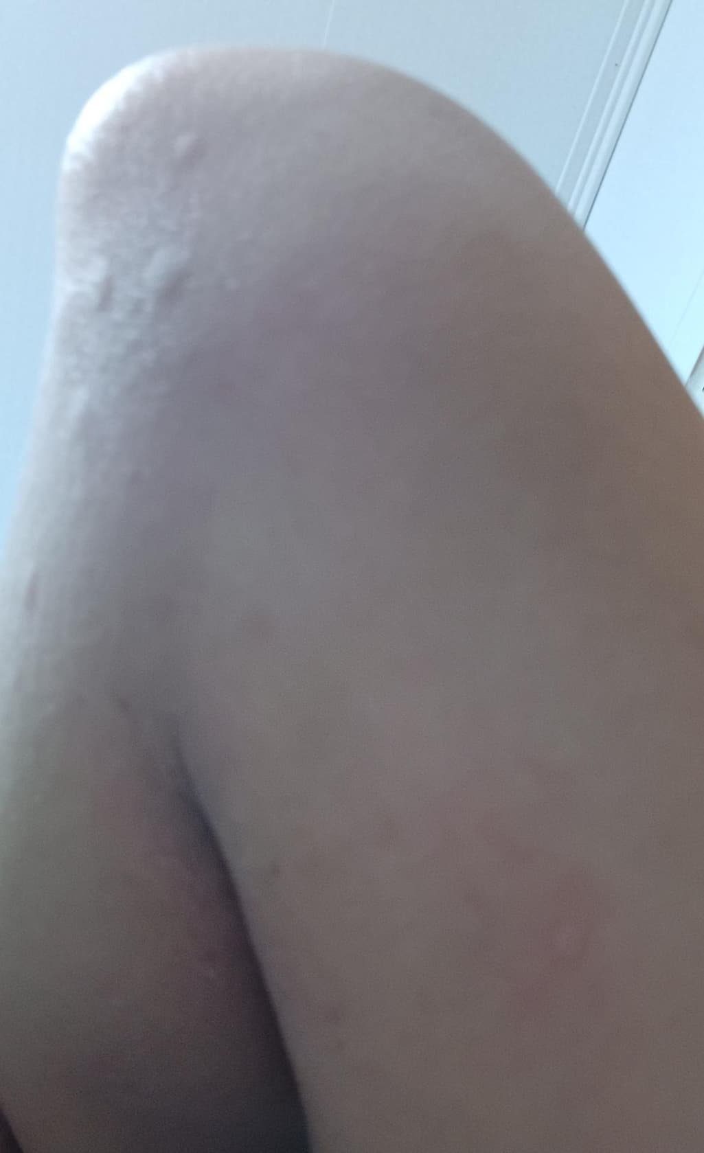 2번 째 사진