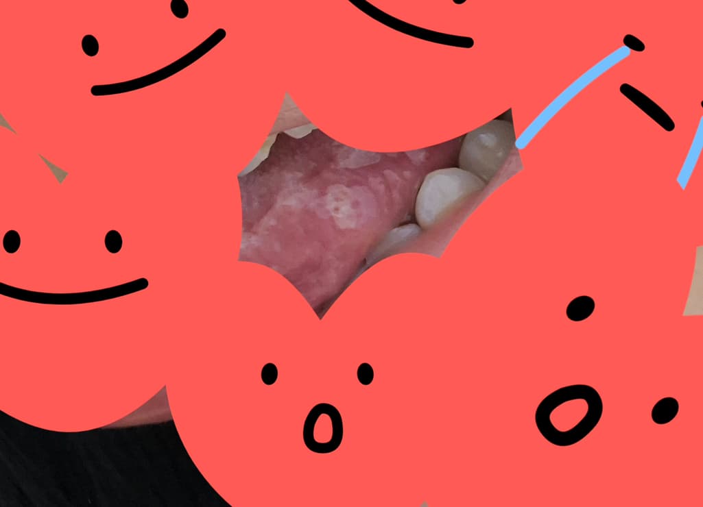 2번 째 사진