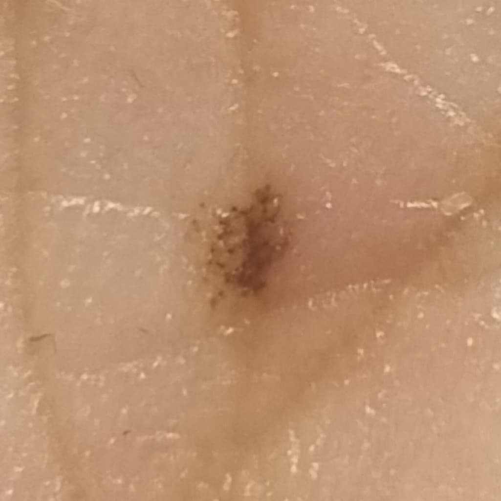 2번 째 사진