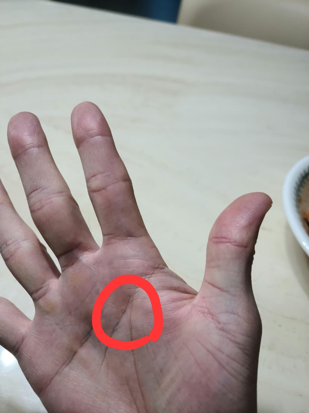 2번 째 사진