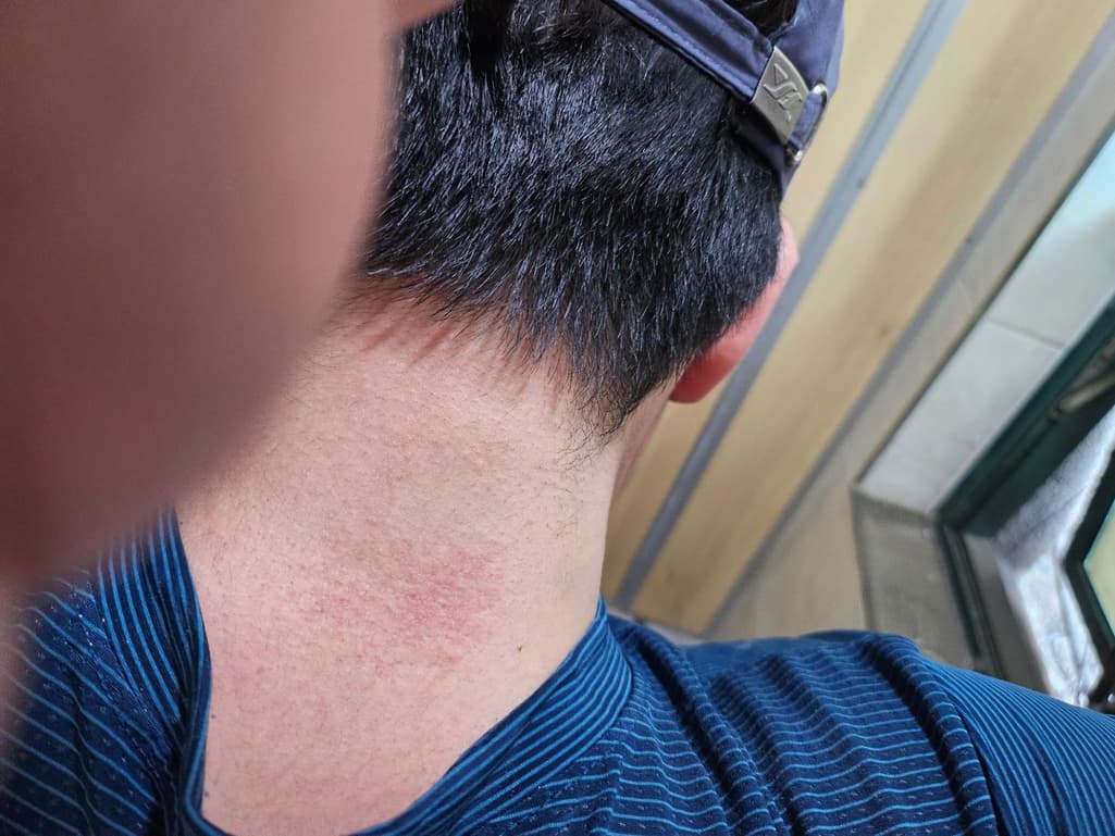 2번 째 사진