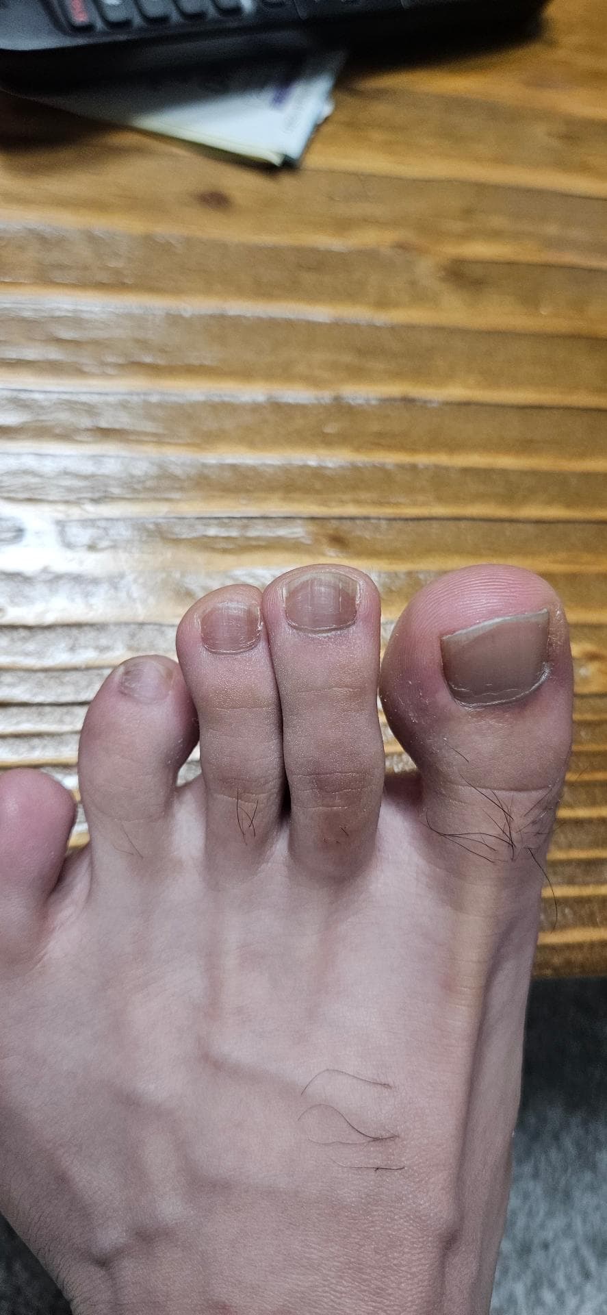 2번 째 사진