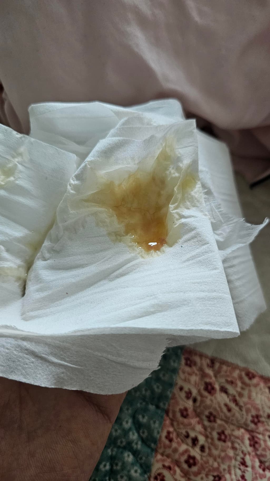 2번 째 사진