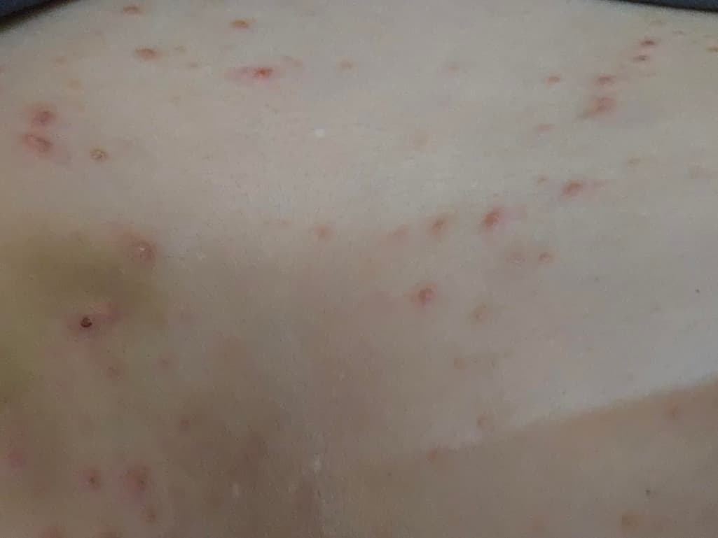 2번 째 사진