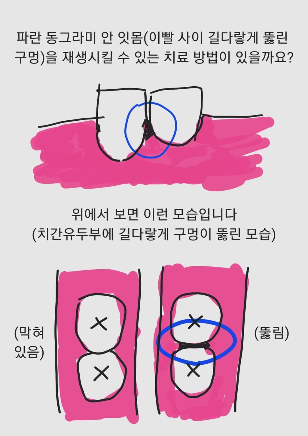 2번 째 사진