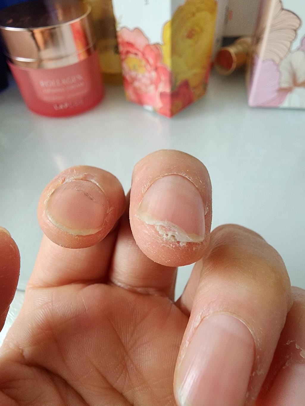 3번 째 사진