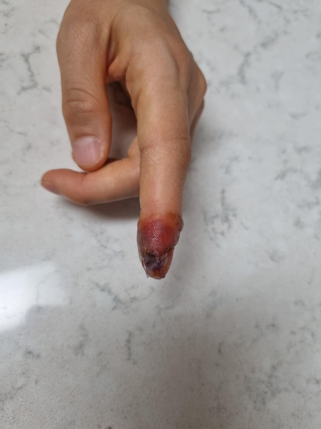 4번 째 사진