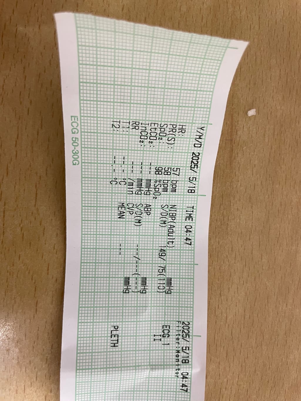 2번 째 사진