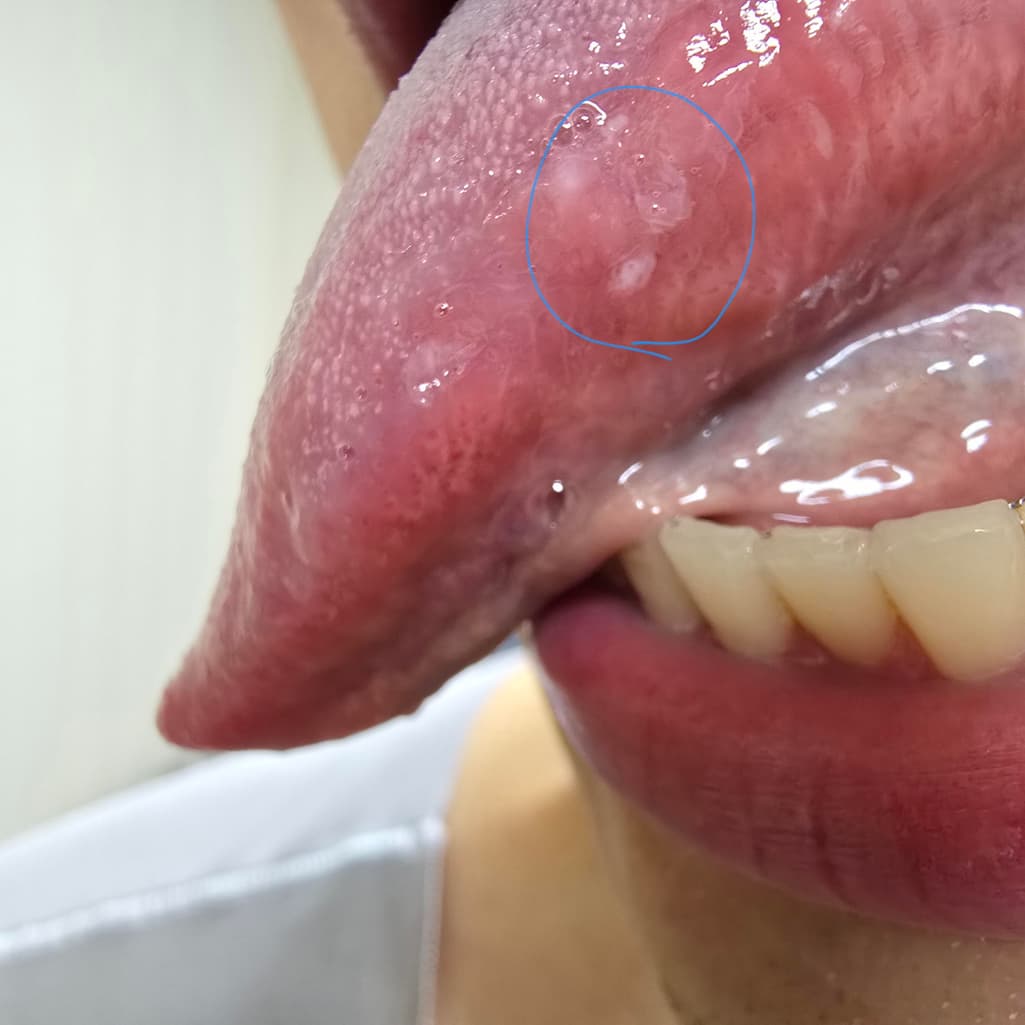 2번 째 사진