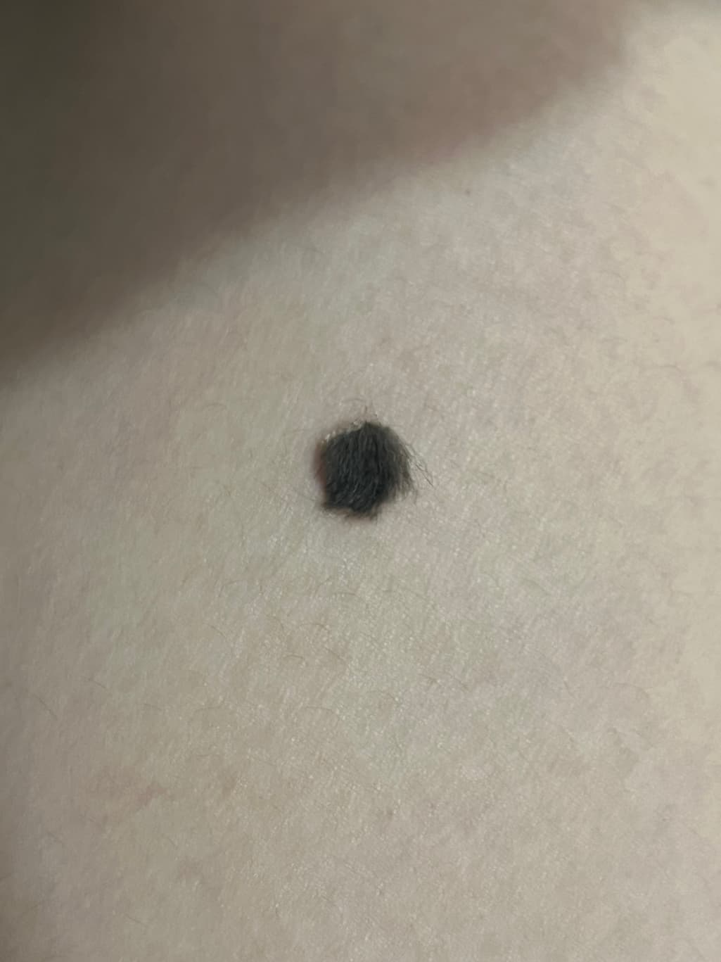2번 째 사진