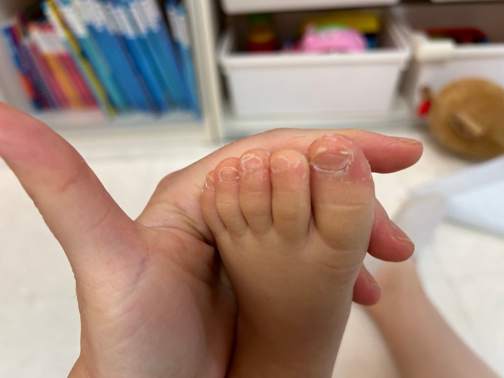 2번 째 사진