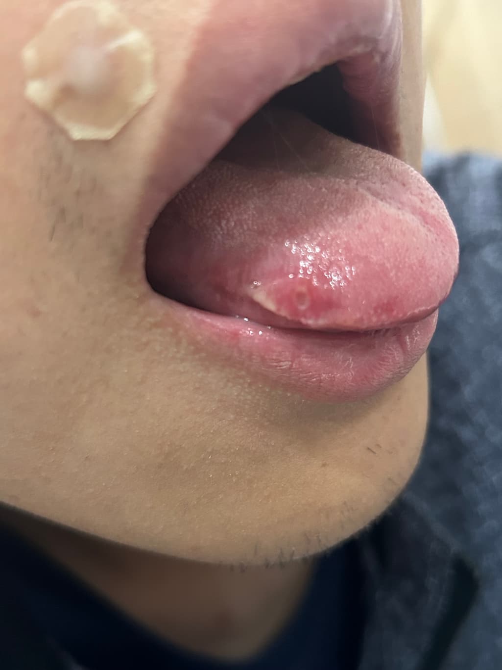 1번 째 사진