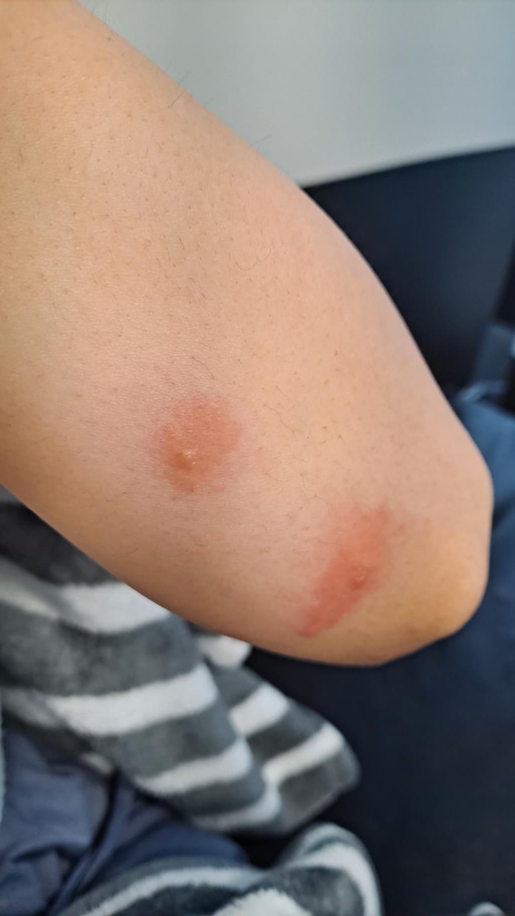 2번 째 사진