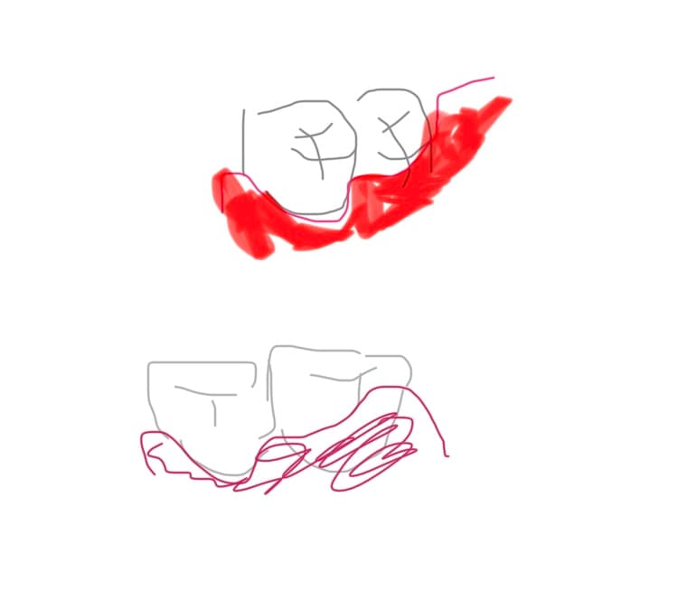 1번 째 사진