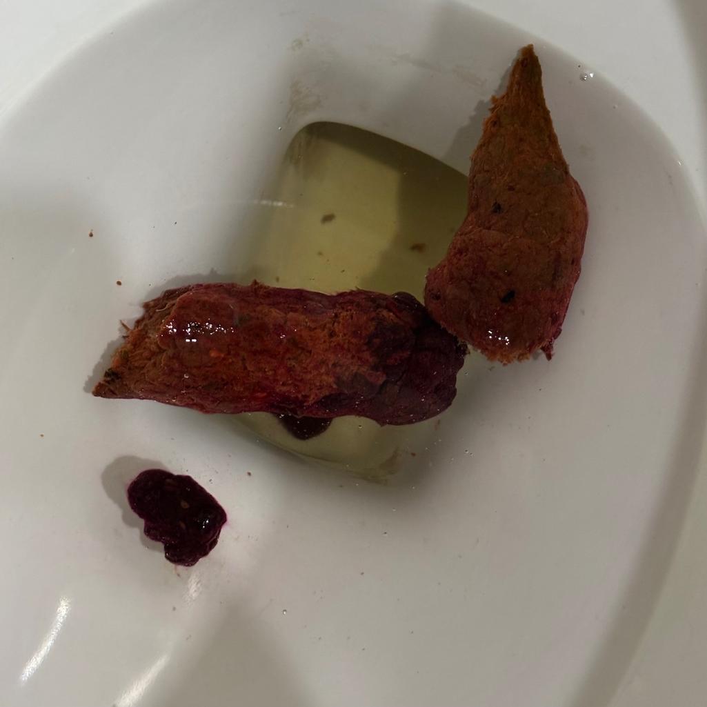 2번 째 사진