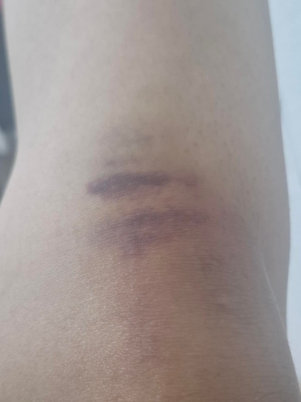 2번 째 사진