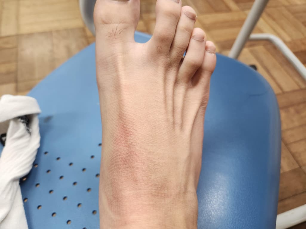 1번 째 사진