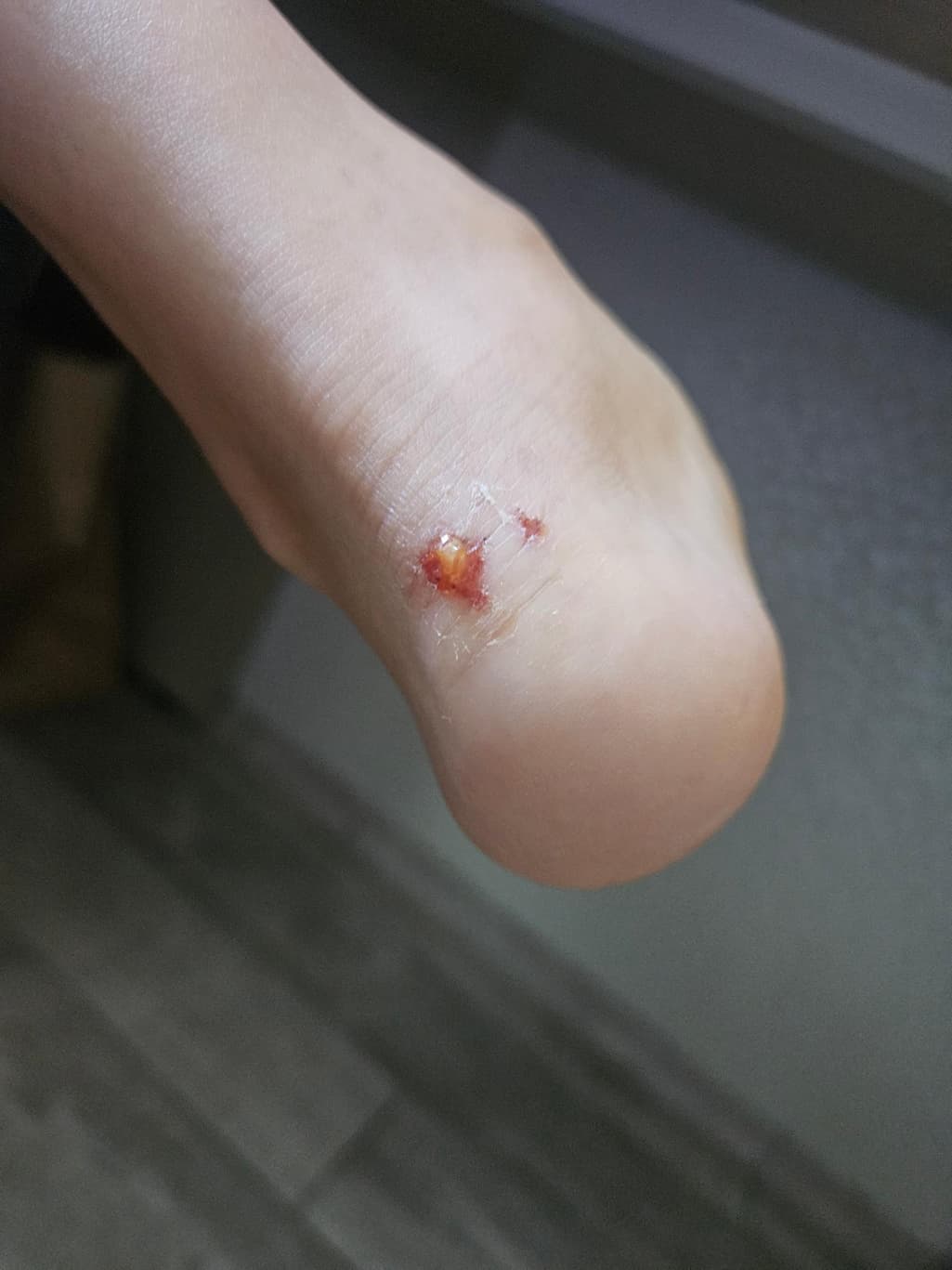 1번 째 사진