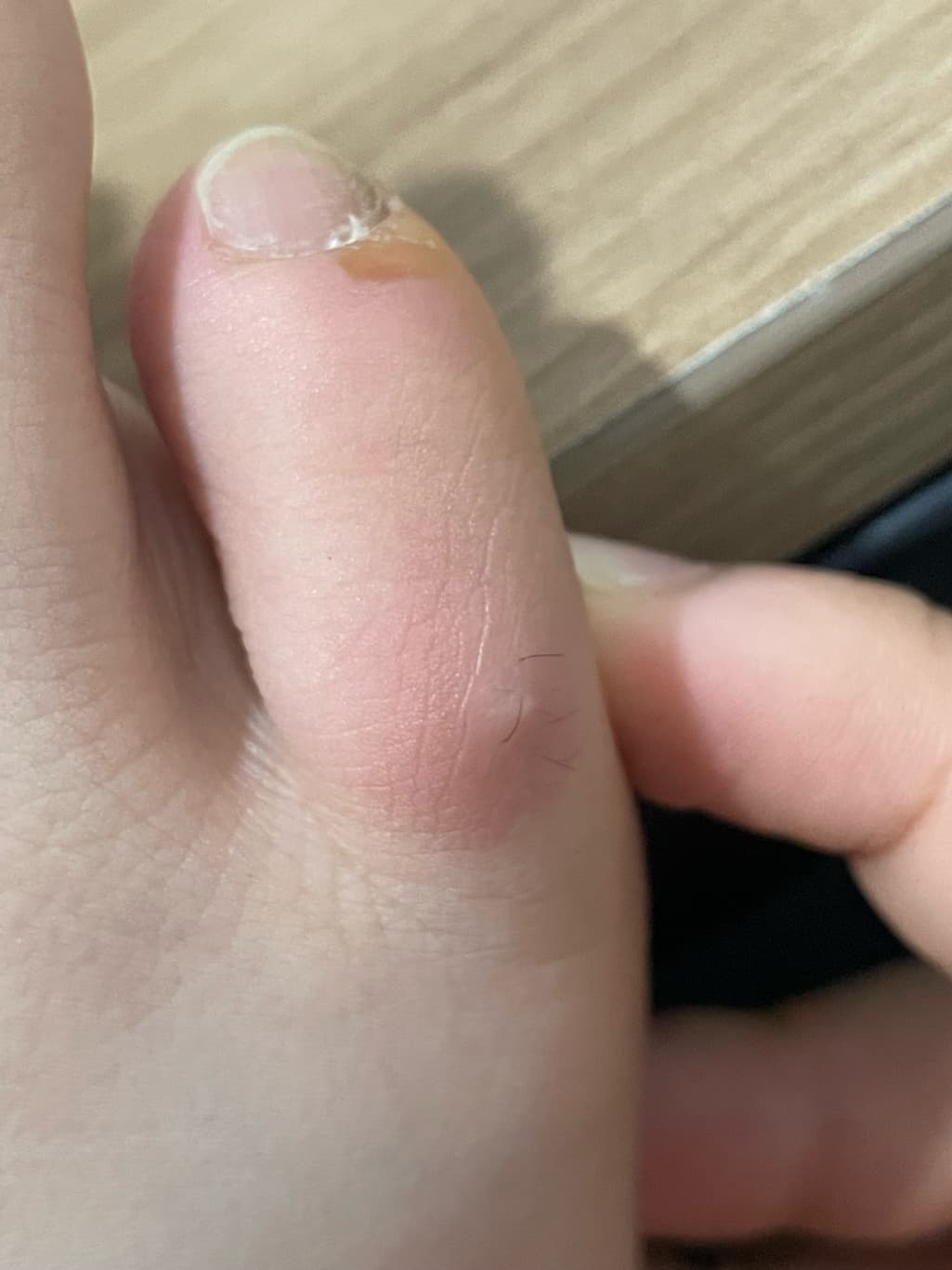 2번 째 사진