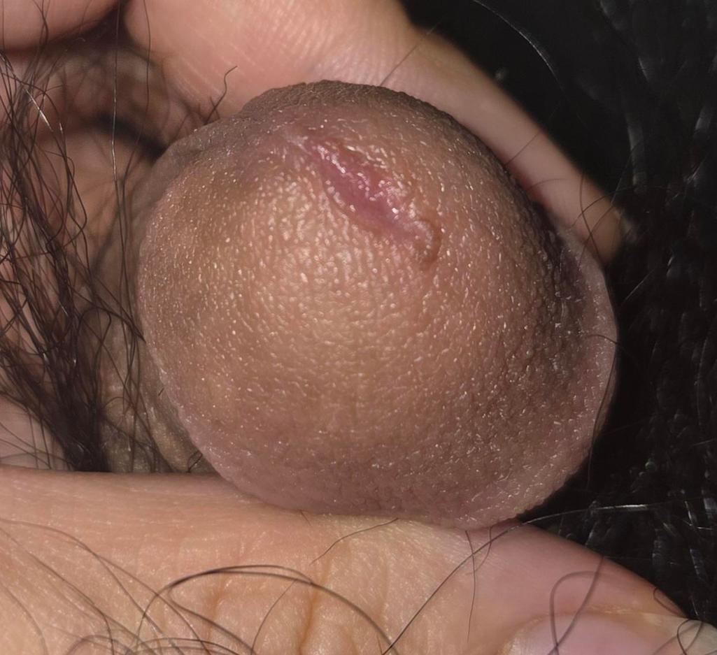 4번 째 사진