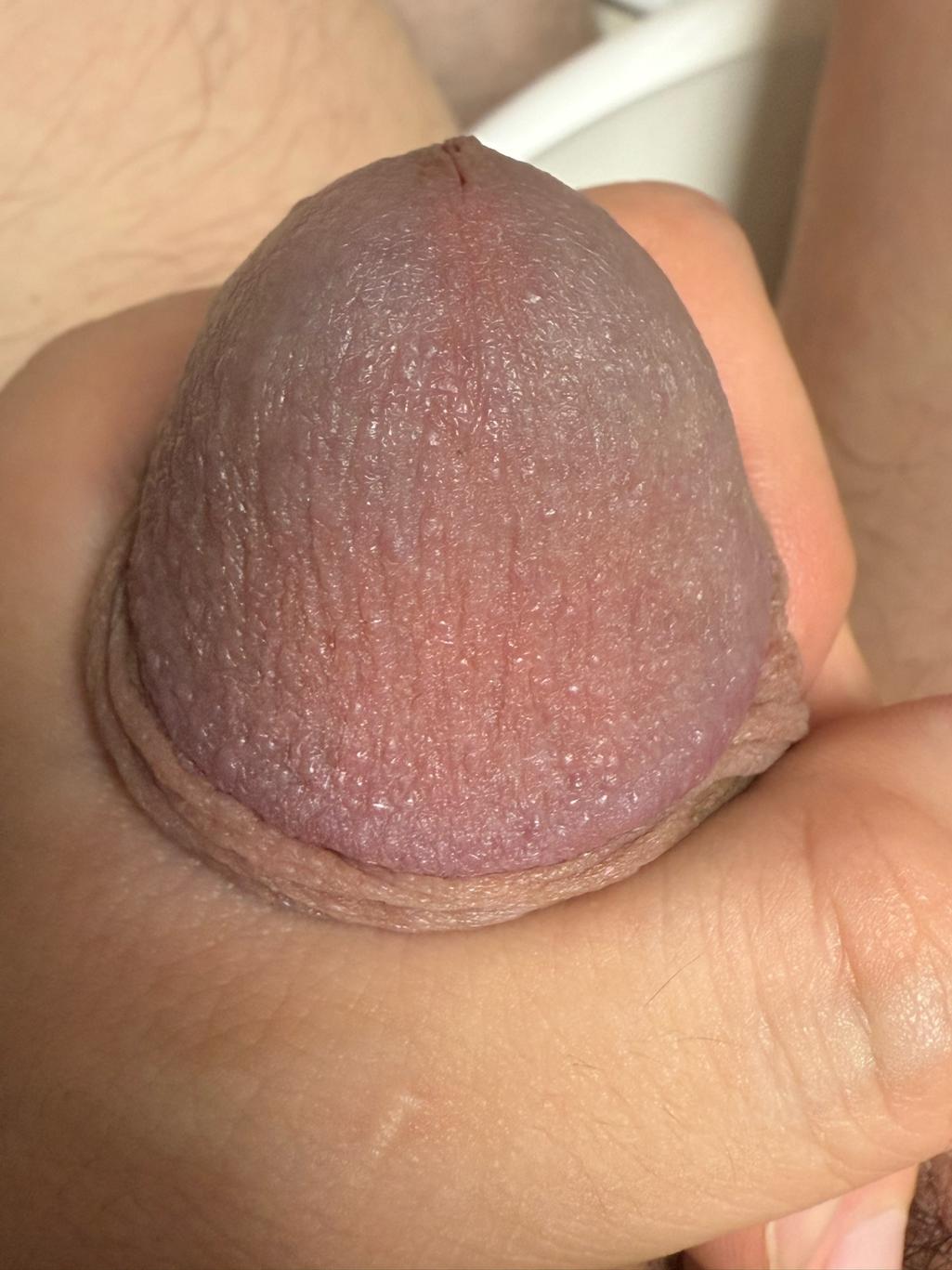 2번 째 사진