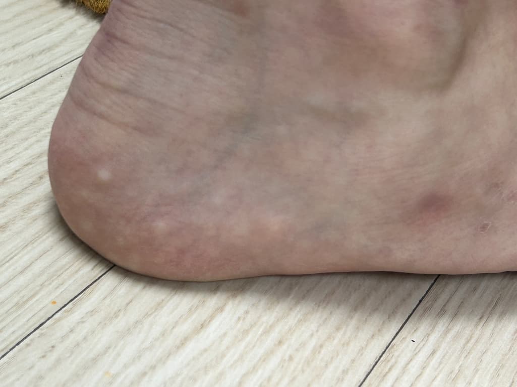 2번 째 사진