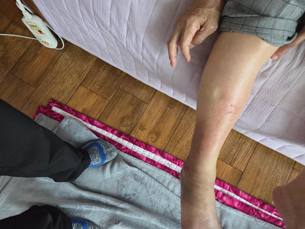 2번 째 사진