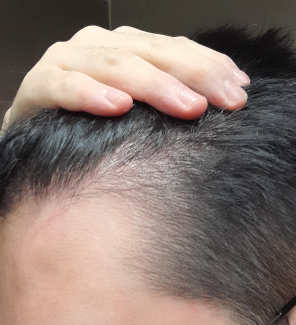 3번 째 사진
