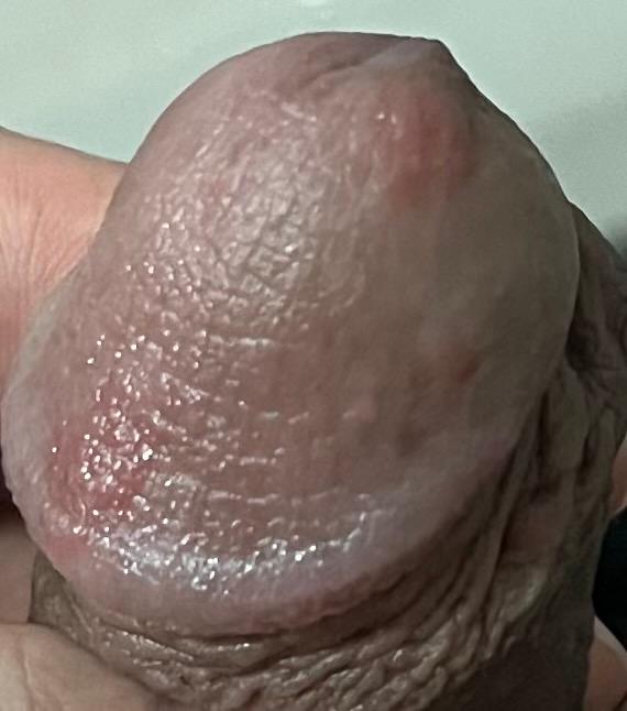 2번 째 사진