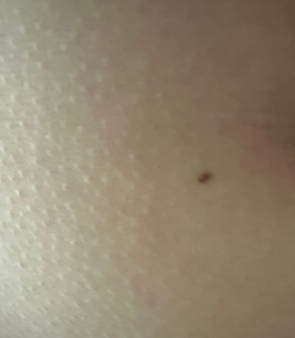 2번 째 사진