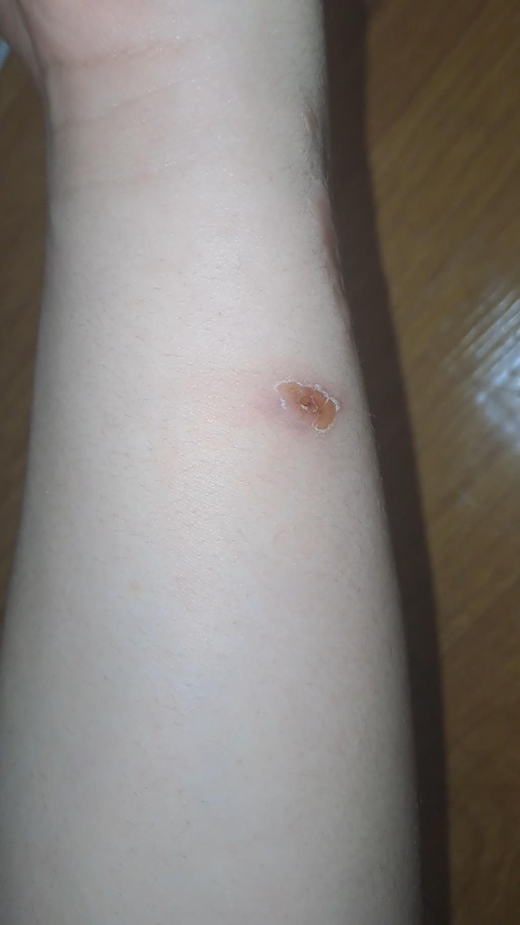1번 째 사진
